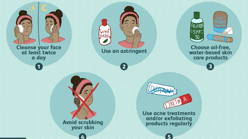 Oily Skin Acne Treatment – 5 Tips For Great Skin Care