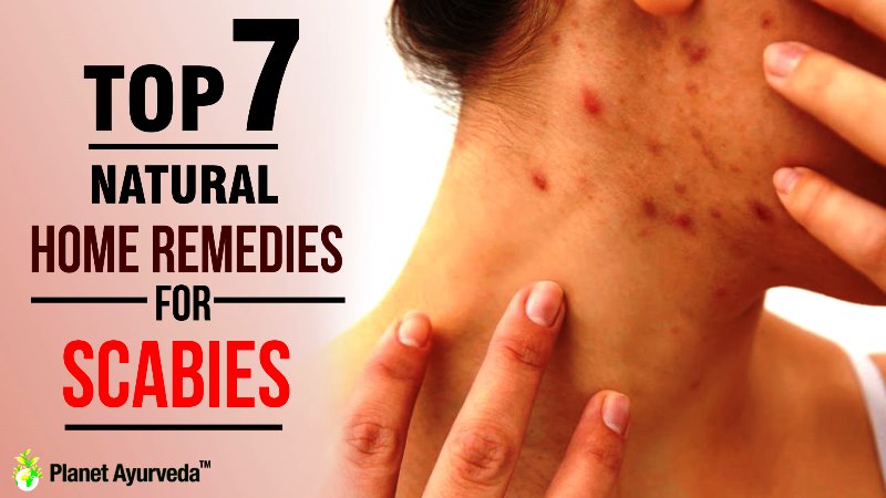 Home Remedies For Scabies